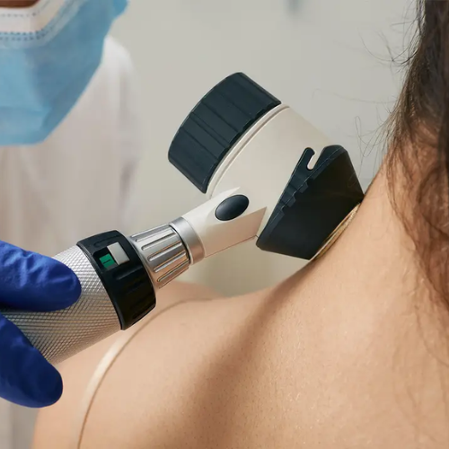 Best Skin Biopsy & Dermoscopy in Pokhran Road 2